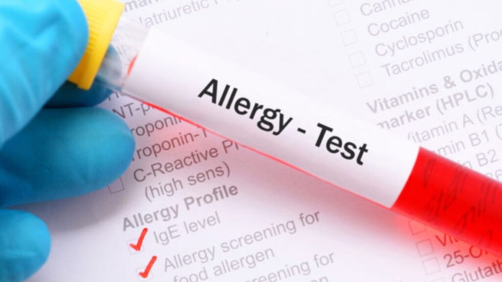 Understanding Food Allergies: A Comprehensive Guide