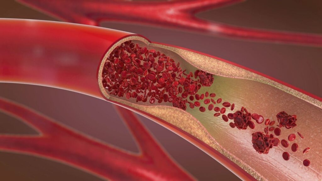 Vitamin E and Heart Health: Exploring Its Benefits in Reducing Cardiovascular Risk