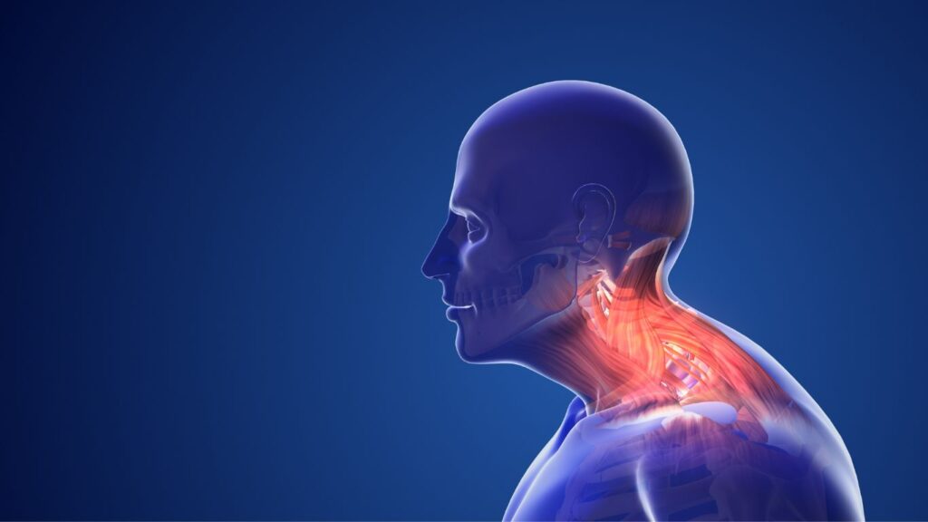 How Poor Posture Can Lead to a Neck Hump: Prevention and Treatment Tips